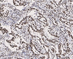 p70 S6 Kinase/S6K [p Thr389] Antibody (PSH02-23), Novus Biologicals 100