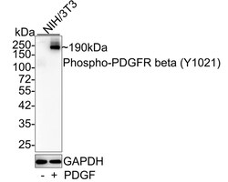 PDGF R beta [p Tyr1021] Antibody (JE48-54), Novus Biologicals 100 &mu;L;
