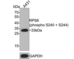 Ribosomal Protein S6/RPS6 [p Ser240, p Ser244] Antibody (PS00-65), Novus Biologicals 100 &mu;L | Buy Online | Novus Biologicals | Fisher Scientific