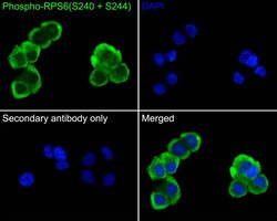 Ribosomal Protein S6/RPS6 [p Ser240, p Ser244] Antibody (PS00-65), Novus Biologicals 100 &mu;L | Buy Online | Novus Biologicals | Fisher Scientific