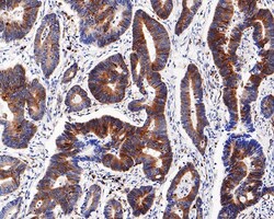 Ribosomal Protein S6/RPS6 [p Ser240, p Ser244] Antibody (PS00-65), Novus Biologicals 100 &mu;L | Buy Online | Novus Biologicals | Fisher Scientific