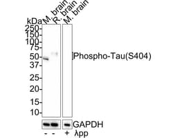 Tau [p Ser404] Antibody (JE66-82), Novus Biologicals 100 &mu;L; Unconjugated:Antibodies,