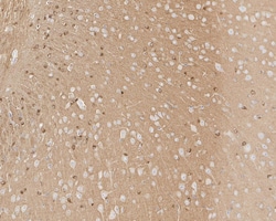 Tau [p Ser404] Antibody (JE66-82), Novus Biologicals 100 &mu;L; Unconjugated:Antibodies,