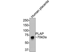 Alkaline Phosphatase/ALPP Antibody (PD00-19), Novus Biologicals 100 &mu;L | Buy Online | Novus Biologicals | Fisher Scientific