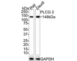 PLC-gamma 2 Antibody (JE39-12), Novus Biologicals 100 &mu;L; Unconjugated:Antibodies,