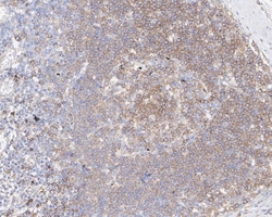 PLC-gamma 2 Antibody (JE39-12), Novus Biologicals 100 &mu;L; Unconjugated:Antibodies,