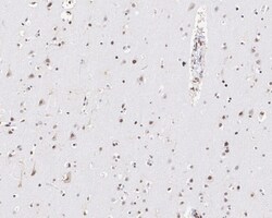 PML Protein Antibody (PSH02-89), Novus Biologicals 100 &mu;L; Unconjugated:Antibodies,