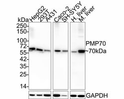 PMP70 Antibody (PSH03-27), Novus Biologicals 100 &mu;L; Unconjugated:Antibodies