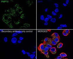 PMP70 Antibody (PSH03-27), Novus Biologicals 100 &mu;L; Unconjugated:Antibodies