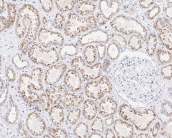 PMP70 Antibody (PSH03-27), Novus Biologicals 100 &mu;L; Unconjugated:Antibodies