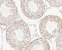 DNA Polymerase delta, catalytic subunit Antibody (JE35-73), Novus Biologicals