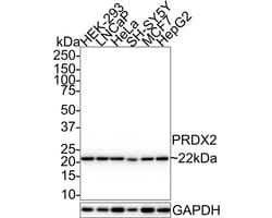 Peroxiredoxin 2 Antibody (7F5-R), Novus Biologicals 100 &mu;L; Unconjugated:Antibodies,
