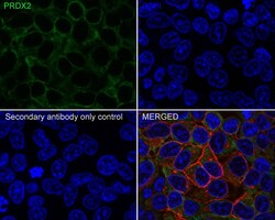 Peroxiredoxin 2 Antibody (7F5-R), Novus Biologicals 100 &mu;L; Unconjugated:Antibodies,