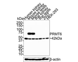 PRMT6 Antibody (JE36-57), Novus Biologicals 100 &mu;L; Unconjugated:Antibodies,