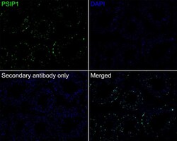 LEDGF Antibody (PSH02-55), Novus Biologicals 100 &mu;L; Unconjugated:Antibodies,