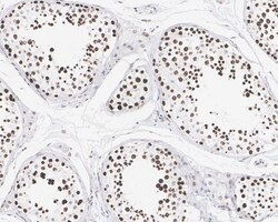 LEDGF Antibody (PSH02-55), Novus Biologicals 100 &mu;L; Unconjugated:Antibodies,