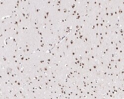 PTBP2 Antibody (JE66-55), Novus Biologicals 100 &mu;L; Unconjugated:Antibodies,