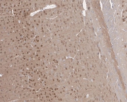 PTEN Antibody (JE51-96), Novus Biologicals 100 &mu;L; Unconjugated:Antibodies,