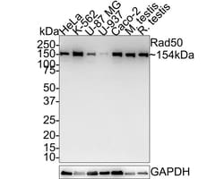 Rad50 Antibody (JE60-04), Novus Biologicals 100 &mu;L; Unconjugated:Antibodies,