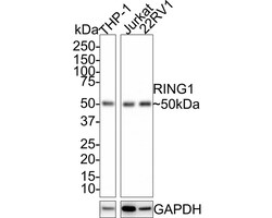 RING1 Antibody (JE34-66), Novus Biologicals 100 &mu;L; Unconjugated:Antibodies,