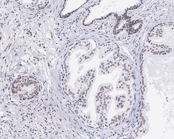 RING1 Antibody (JE34-66), Novus Biologicals 100 &mu;L; Unconjugated:Antibodies,