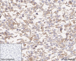 RIPK3/RIP3 Antibody (PSH04-79), Novus Biologicals 100 &mu;L; Unconjugated:Antibodies,
