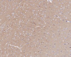 ROCK2 Antibody (JE31-36), Novus Biologicals 100 &mu;L; Unconjugated:Antibodies,