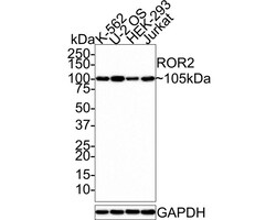 ROR2 Antibody (JE37-72), Novus Biologicals 100 &mu;L; Unconjugated:Antibodies,