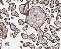 ROR2 Antibody (JE37-72), Novus Biologicals 100 &mu;L; Unconjugated:Antibodies,