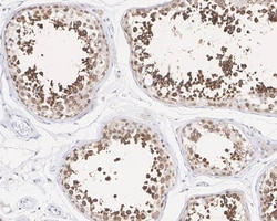 RUVBL2 Antibody (A1E12-R), Novus Biologicals 100 &mu;L | Buy Online | Novus Biologicals | Fisher Scientific