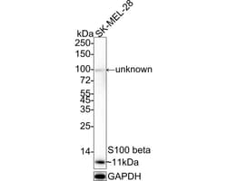 S100B Antibody (PD00-11), Novus Biologicals 100 &mu;L; Unconjugated:Antibodies,