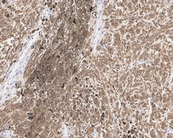 S100B Antibody (PD00-11), Novus Biologicals 100 &mu;L; Unconjugated:Antibodies,