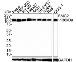 SMC2 Antibody (PSH0-62), Novus Biologicals 100 &mu;L | Buy Online | Novus Biologicals | Fisher Scientific