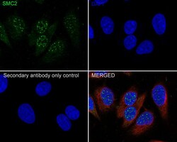 SMC2 Antibody (PSH0-62), Novus Biologicals 100 &mu;L | Buy Online | Novus Biologicals | Fisher Scientific