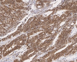 SMC2 Antibody (PSH0-62), Novus Biologicals 100 &mu;L | Buy Online | Novus Biologicals | Fisher Scientific
