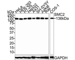 SMC2 Antibody (PSH0-63), Novus Biologicals 100 &mu;L; Unconjugated:Antibodies,