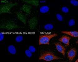 SMC2 Antibody (PSH0-63), Novus Biologicals 100 &mu;L; Unconjugated:Antibodies,