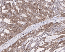 SMC2 Antibody (PSH0-63), Novus Biologicals 100 &mu;L; Unconjugated:Antibodies,