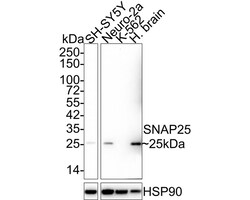 SNAP25 Antibody (JE45-86), Novus Biologicals 100 &mu;L; Unconjugated:Antibodies,