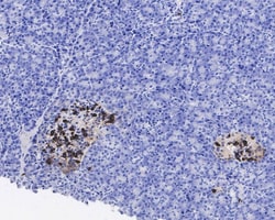 Somatostatin 28 Antibody (JE43-52), Novus Biologicals 100 &mu;L; Unconjugated:Antibodies,