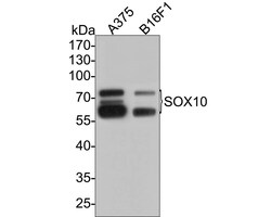 SOX10 Antibody (PDH0-04), Novus Biologicals 100 &mu;L; Unconjugated:Antibodies,