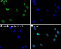 SOX10 Antibody (PDH0-04), Novus Biologicals 100 &mu;L; Unconjugated:Antibodies,