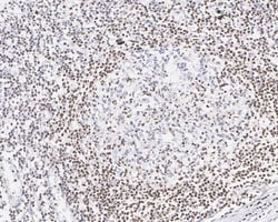 SP110 Antibody (PSH03-66), Novus Biologicals 100 &mu;L; Unconjugated:Antibodies,