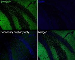 SynGAP Antibody (JE57-79), Novus Biologicals 100 &mu;L; Unconjugated:Antibodies,