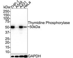 PD-ECGF/Thymidine Phosphorylase Antibody (A1A10-R), Novus Biologicals 100 &mu;L | Buy Online | Novus Biologicals | Fisher Scientific