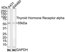 TR alpha/NR1A1/Thyroid Hormone Receptor alpha Antibody (JE40-49), Novus