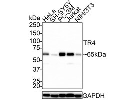 TR4/NR2C2 Antibody (JE45-03), Novus Biologicals 100 &mu;L; Unconjugated:Antibodies,