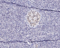 TR4/NR2C2 Antibody (JE45-03), Novus Biologicals 100 &mu;L; Unconjugated:Antibodies,