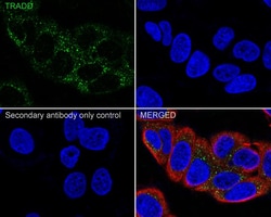 TRADD Antibody (JE32-60), Novus Biologicals 100 &mu;L; Unconjugated:Antibodies,