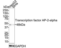 AP2 alpha Antibody (PSH02-06), Novus Biologicals 100 &mu;L | Buy Online | Novus Biologicals | Fisher Scientific